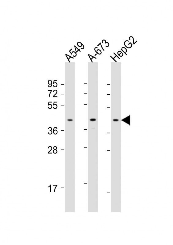 Rabbit Polyclonal Antibody to CSNK2A3