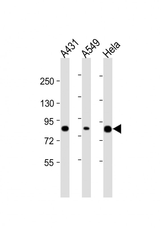 Rabbit Polyclonal Antibody to PLA2G4D