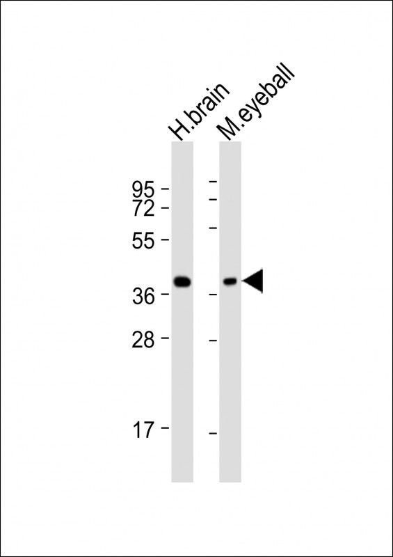 Rabbit Polyclonal Antibody to ARR3 (N-Term)
