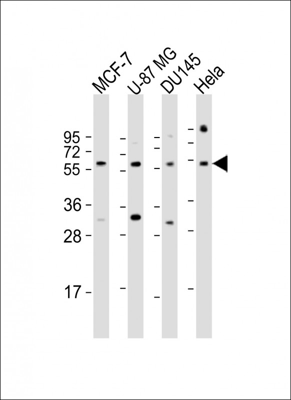 Rabbit Polyclonal Antibody to RGS3 (N-Term)