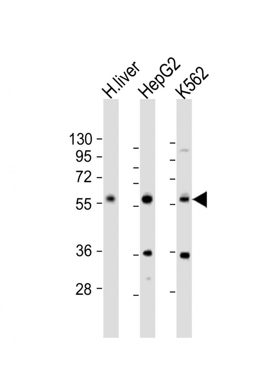 Rabbit Polyclonal Antibody to NAGS