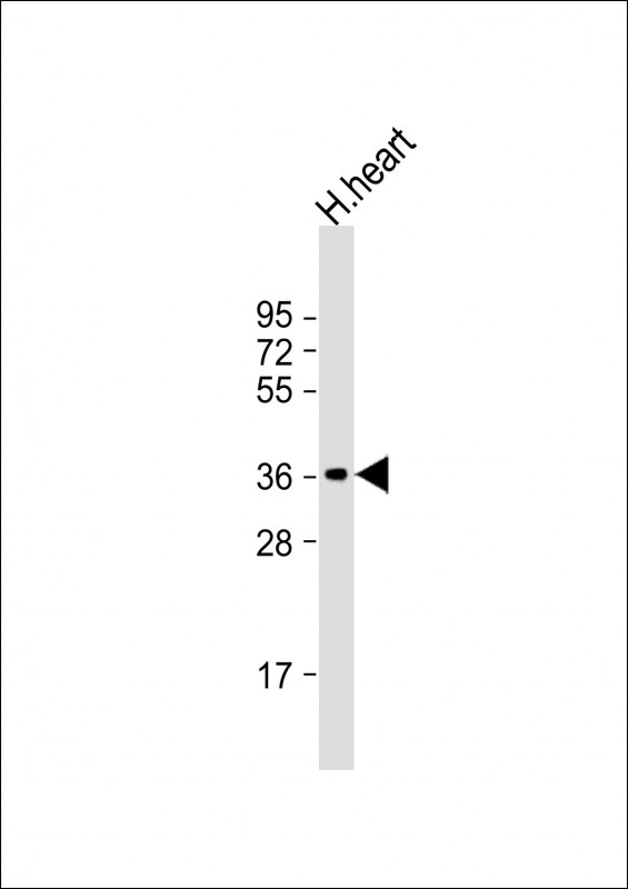 Rabbit Polyclonal Antibody to HUMAN-LDHB(Y240)