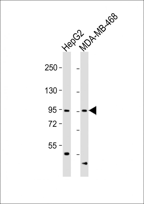 Rabbit Polyclonal Antibody to OPHN1