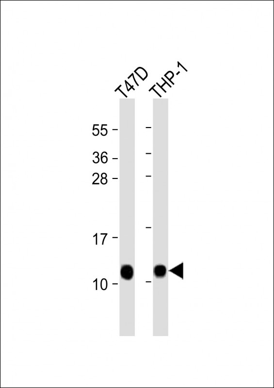 Rabbit Polyclonal Antibody to CRIP1