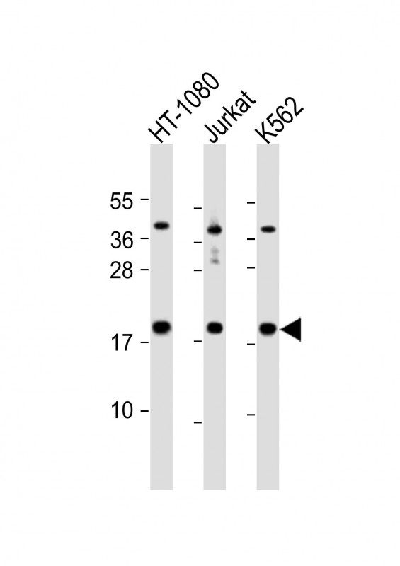 Rabbit Polyclonal Antibody to NAT13