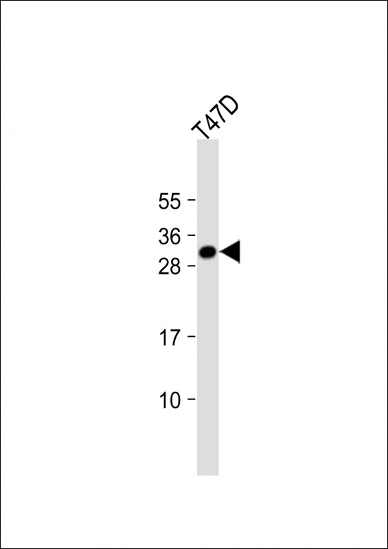 Rabbit Polyclonal Antibody to CRLS1