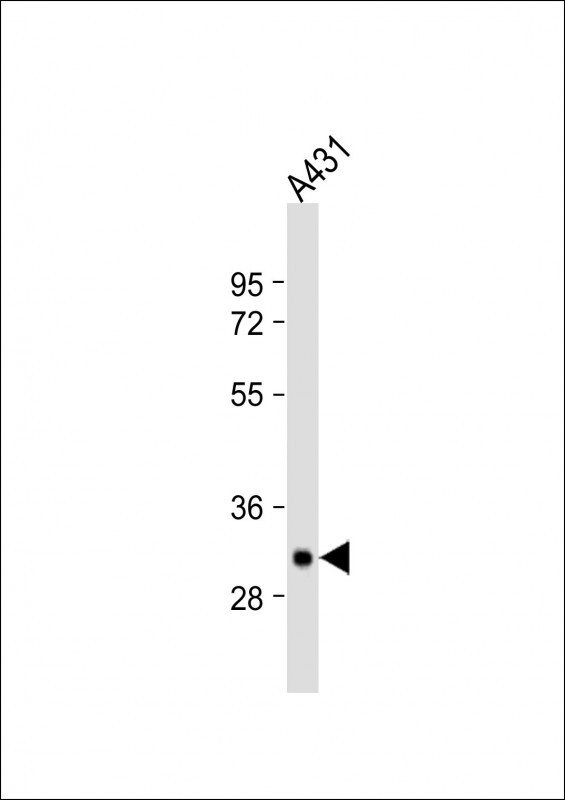 Rabbit Polyclonal Antibody to TPSAB1