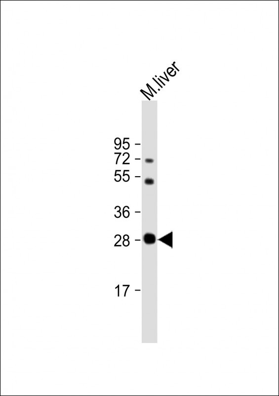 Rabbit Polyclonal Antibody to M Sirt3