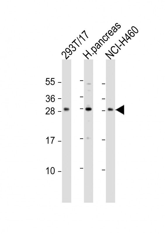 Rabbit Polyclonal Antibody to COMTD1