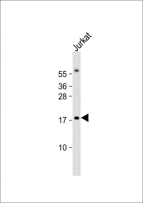 Rabbit Polyclonal Antibody to RBM3