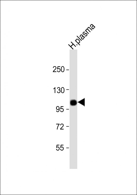 Rabbit Polyclonal Antibody to CFB