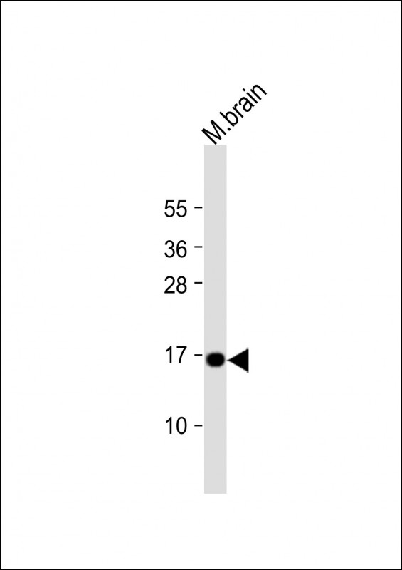 Rabbit Polyclonal Antibody to CPLX1