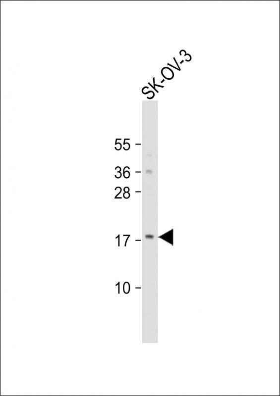 Rabbit Polyclonal Antibody to LYPD1