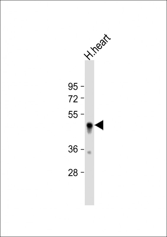 Rabbit Polyclonal Antibody to SDR