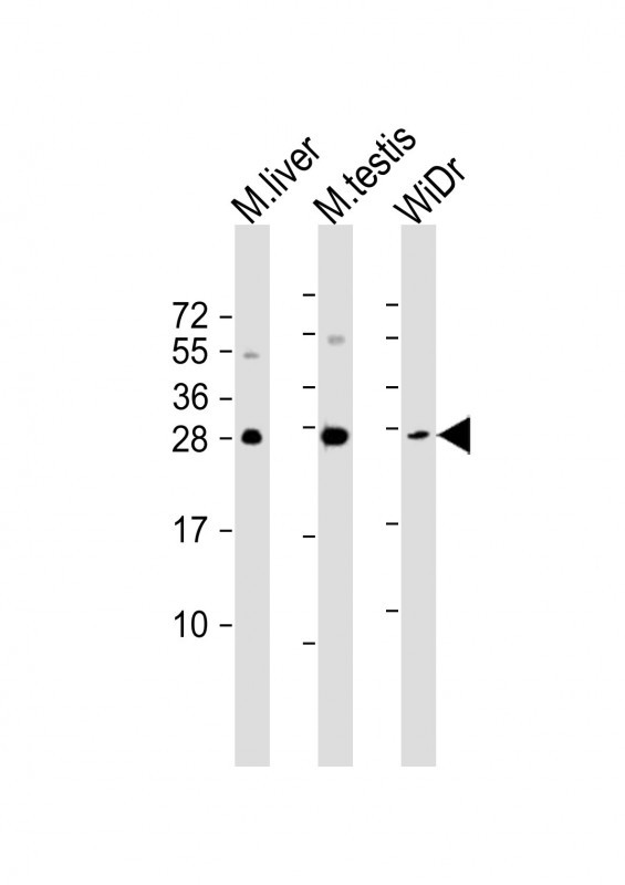 Mouse Monoclonal Antibody to CDX1