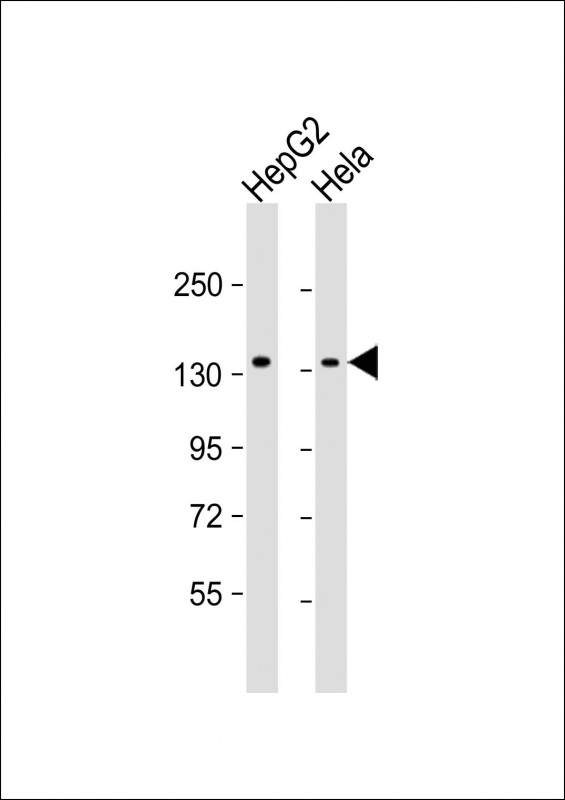 Mouse Monoclonal Antibody to RBM6