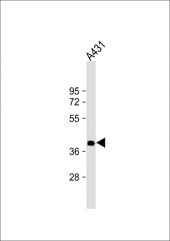 Mouse Monoclonal Antibody to NMI