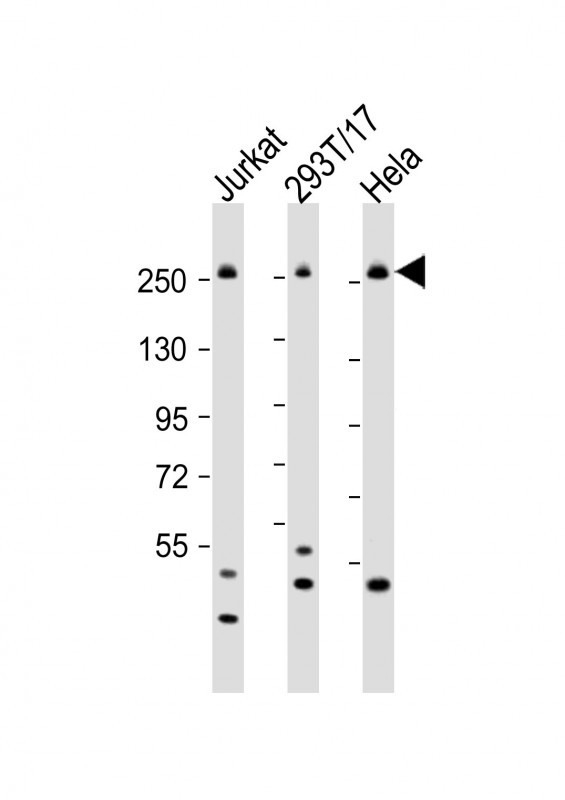 Rabbit Polyclonal Antibody to CAD