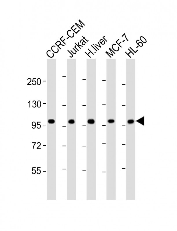 Rabbit Polyclonal Antibody to RSBN1 (N-term)