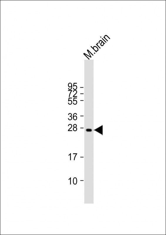 Rabbit Polyclonal Antibody to VKORC1L1 (N-term)