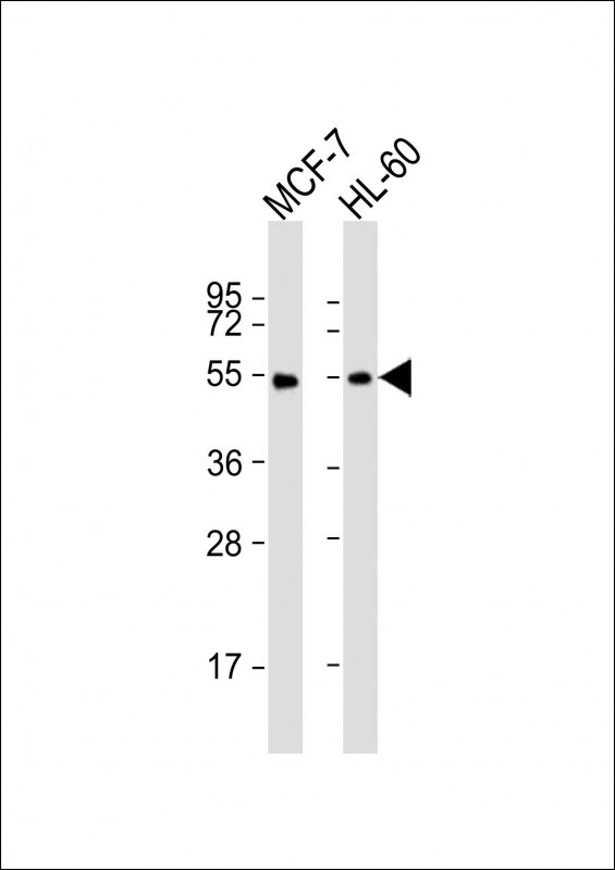 Rabbit Polyclonal Antibody to LPL