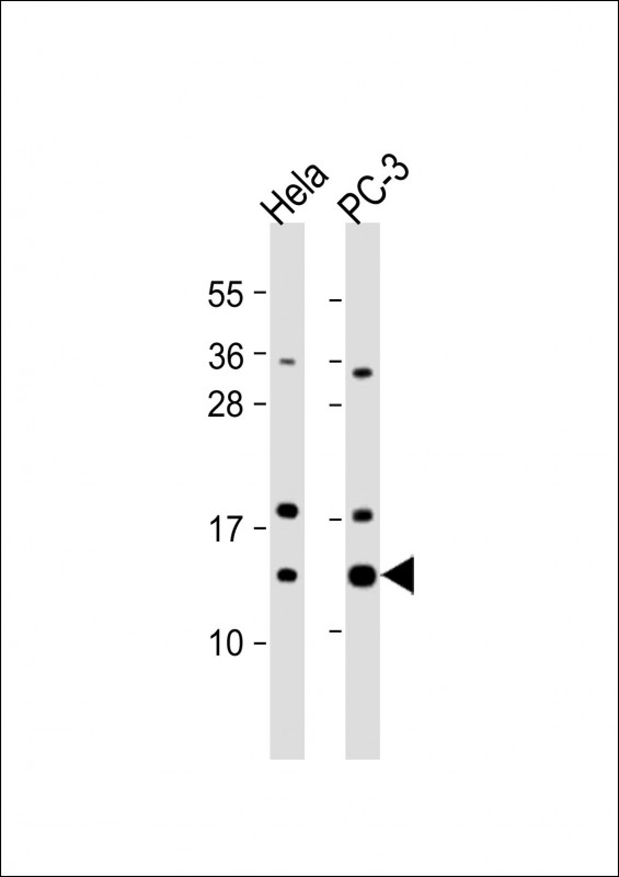 Rabbit Polyclonal Antibody to TCEB1