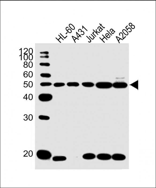 Rabbit Polyclonal Antibody to KRT28
