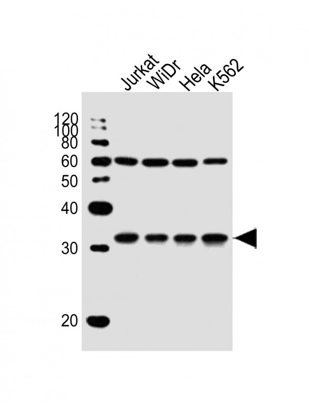 Rabbit Polyclonal Antibody to EXOSC6 (N-term)