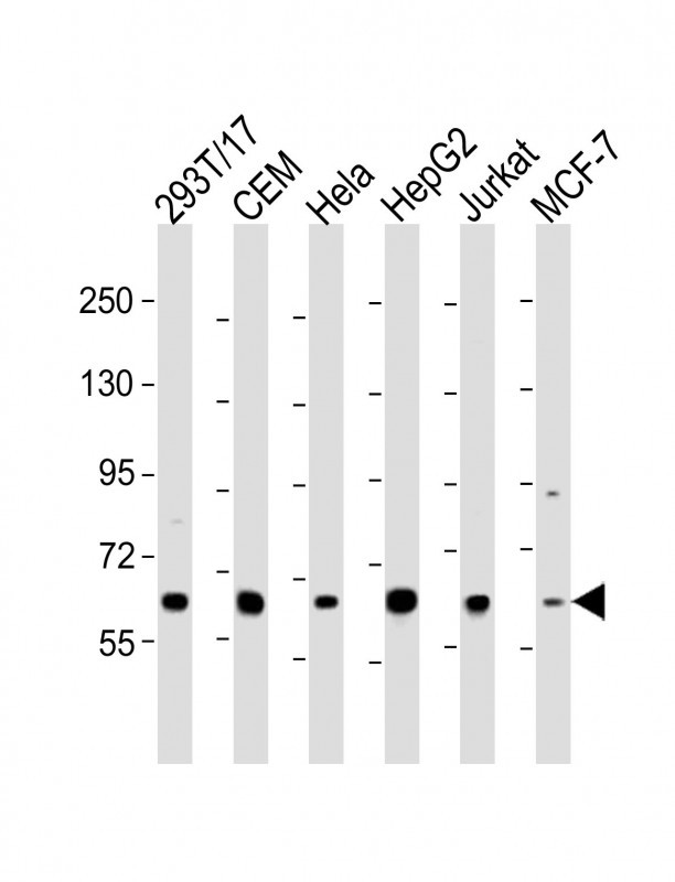Rabbit Polyclonal Antibody to RNF31