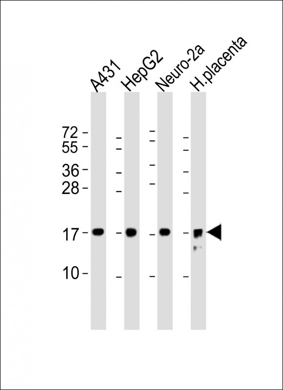 Rabbit Polyclonal Antibody to RPL22(C-term)
