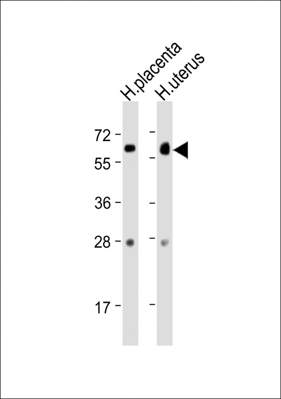 Rabbit Polyclonal Antibody to ZBTB7C (N-Term)