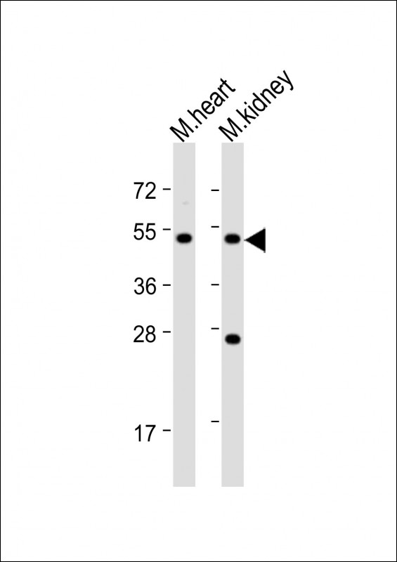 Rabbit Polyclonal Antibody to PIGU (N-Term)