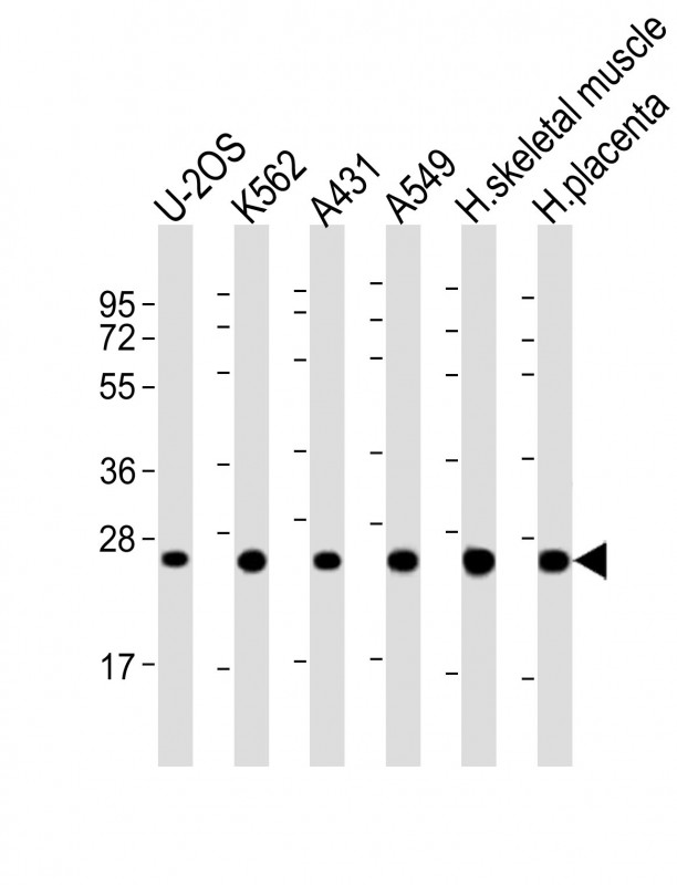 Rabbit Polyclonal Antibody to UQCRFS1P1