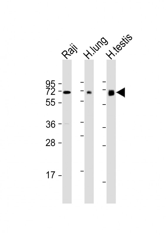 Rabbit Polyclonal Antibody to ERVK-7 (N-Term)
