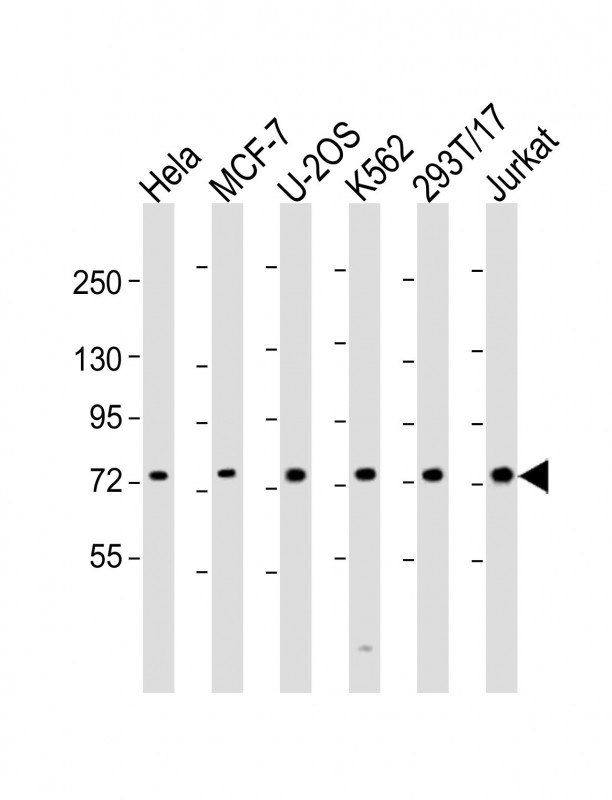 Rabbit Polyclonal Antibody to NDC80