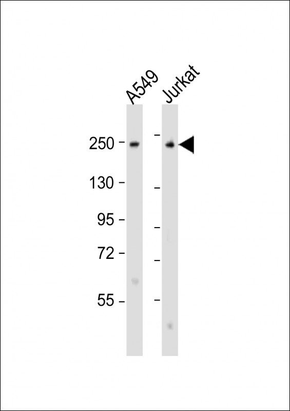 Rabbit Polyclonal Antibody to COL11A1 (N-Term)