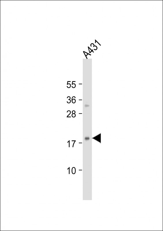 Rabbit Polyclonal Antibody to H3f3b