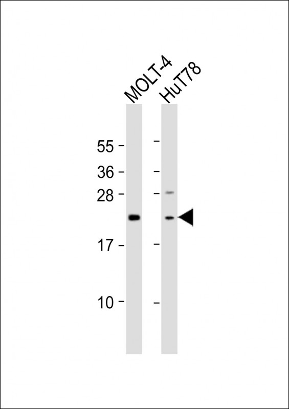 Rabbit Polyclonal Antibody to DLEU7 (N-Term)