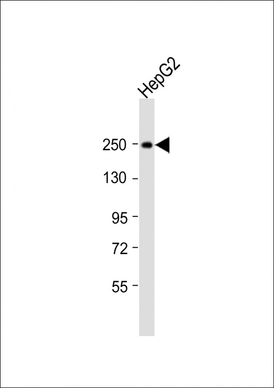 Rabbit Polyclonal Antibody to MYO5B (N-Term)