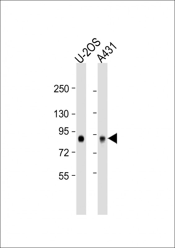 Rabbit Polyclonal Antibody to GPSM2 (N-Term)