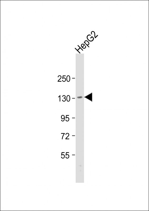 Rabbit Polyclonal Antibody to TMF1