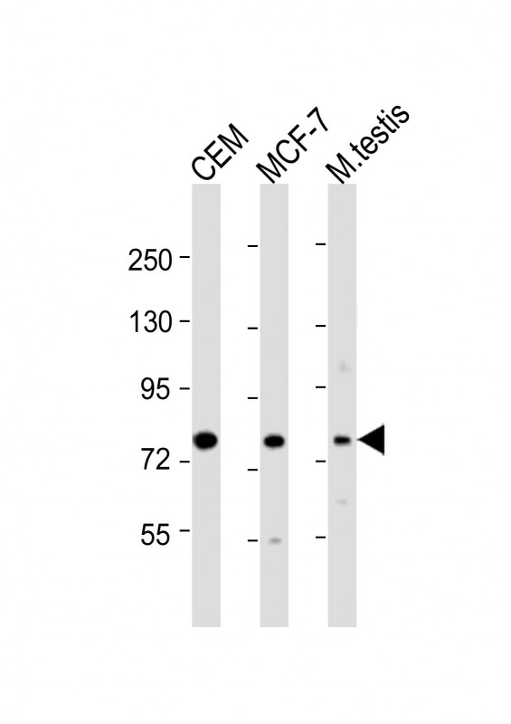 Rabbit Polyclonal Antibody to MYBL2