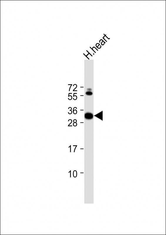 Rabbit Polyclonal Antibody to CLIC2