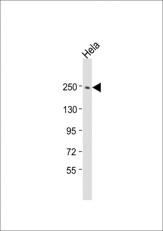 Rabbit Polyclonal Antibody to APC2 (N-Term)