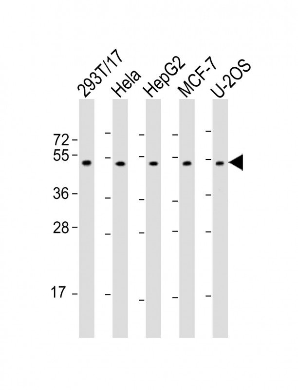 Rabbit Polyclonal Antibody to PLAGL1 (N-Term)