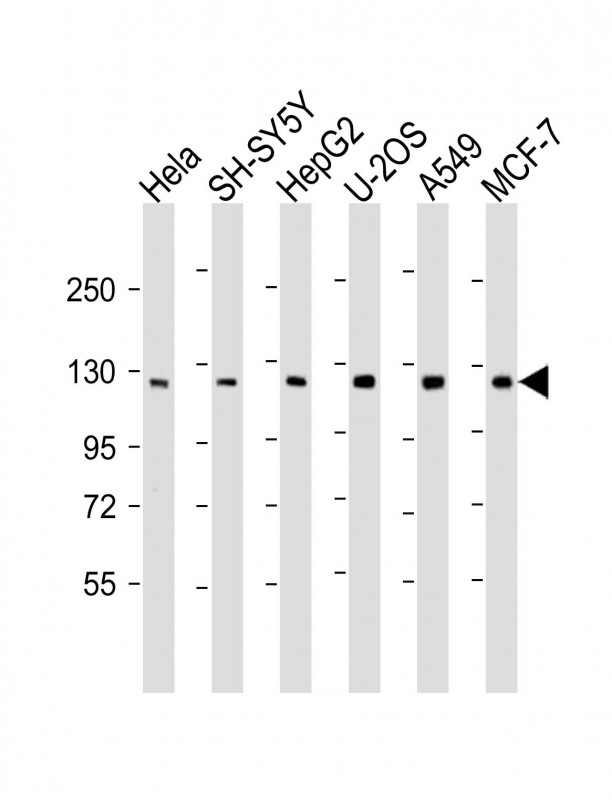 Rabbit Polyclonal Antibody to PHC3