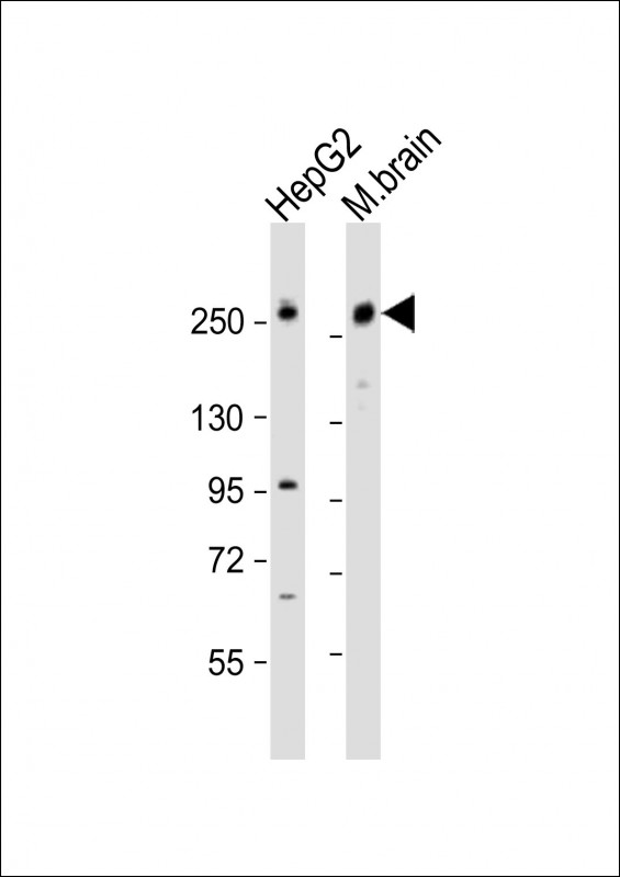 Rabbit Polyclonal Antibody to RALGAPA1 (N-Term)