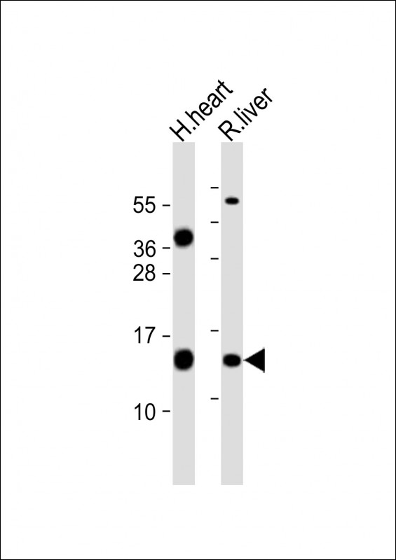Rabbit Polyclonal Antibody to FXC1 (N-term)
