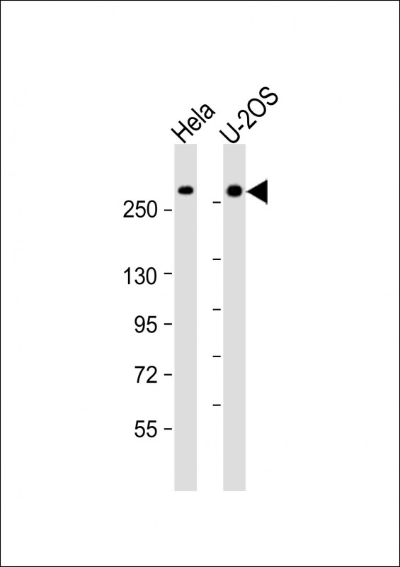 Rabbit Polyclonal Antibody to FANCM