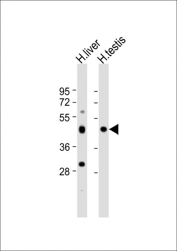 Rabbit Polyclonal Antibody to CHTF8 (N-Term)